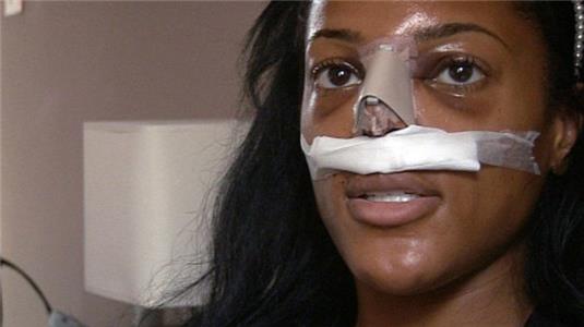 Bleach, Nip, Tuck: The White Beauty Myth Episode #1.2 (2009– ) watch online HD