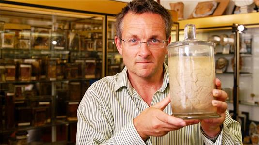 The Brain: A Secret History Broken Brains (2011) watch online HD