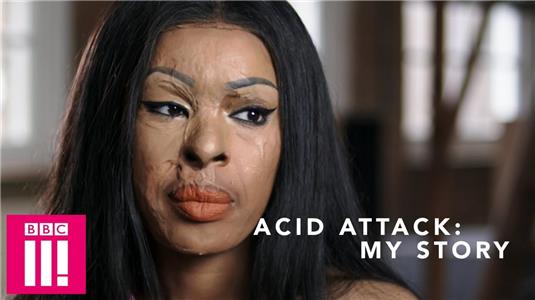 Acid Attack: My Story (2018) watch online HD