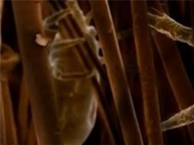 Shapes of the Invisible Louse (1997–1998) watch online HD